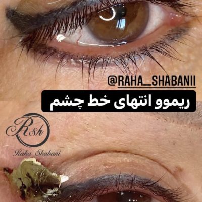 ریموو تاتو ابرو، خط چشم و شیدینگ